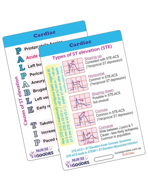 Sci-Ed CARDIAC ÃƒÂ¢Ã¢â€šÂ¬Ã¢â‚¬Å“ ECG 4 ST ELEVATION